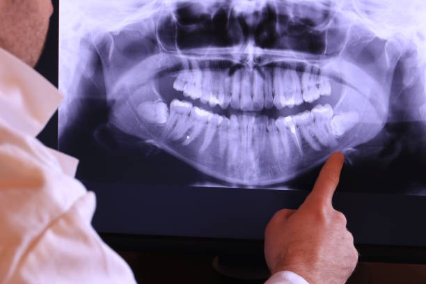 Best Broken or Cracked Tooth Emergency Dentist in Monarch Mill, SC