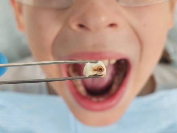Best Mobile Emergency Dentist in Monarch Mill, SC